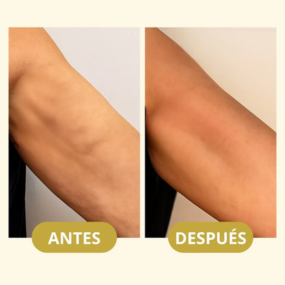 MagicFirm™ Aceite Corporal de Lujo | Reafirma la piel un 90% en 4 semanas - 100% GARANTIZADO
