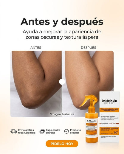 Antes y después - imagen ilustrativa