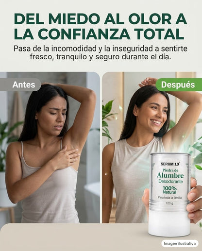Antes y después - imagen ilustrativa