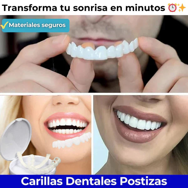 Carillas Dentales Monturas - ¡Sonrisa Perfecta al Instante!